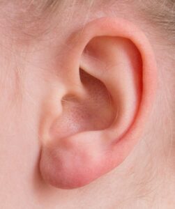 hearing loss attorney louisiana